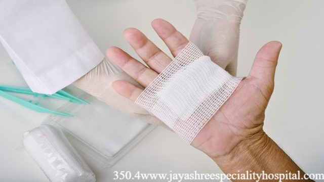 Metode Merawat Luka Operasi Supaya Cepat Kering