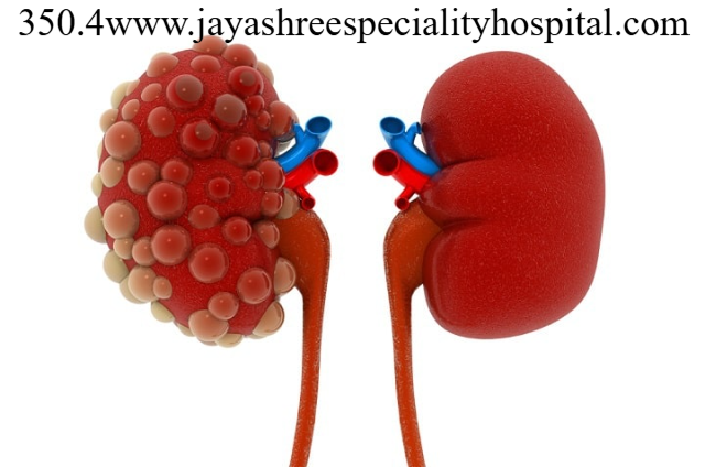 Gagal Ginjal Kronis: Cerita Pemuda Harus Rutin Cuci Darah